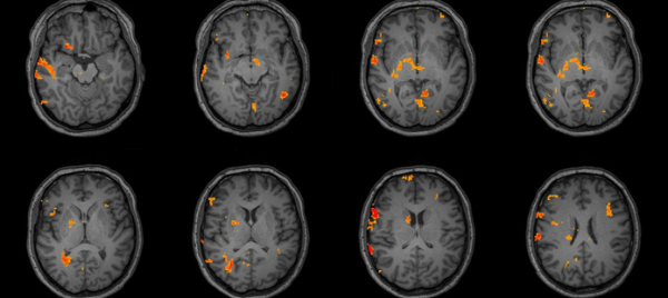  Human Neuropsychology 