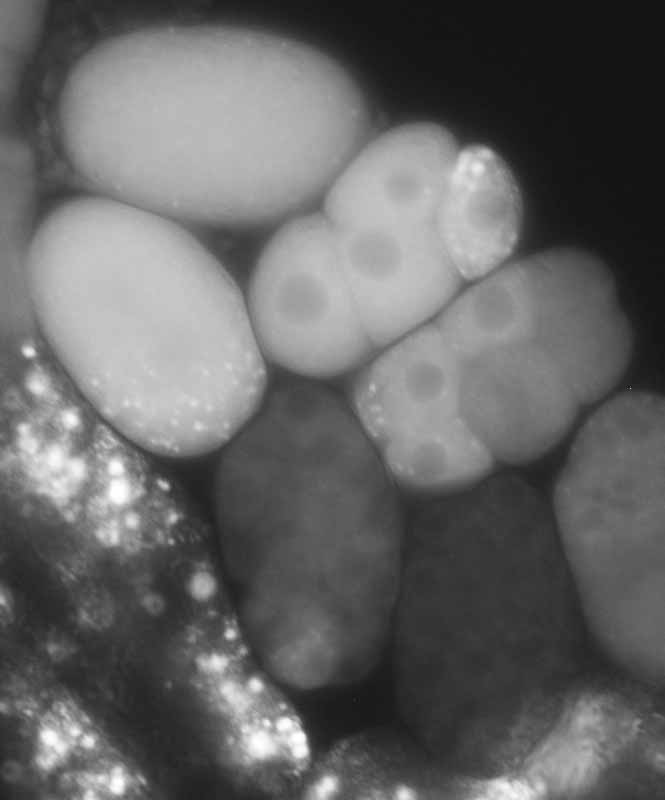 GFP nematode worm embryos